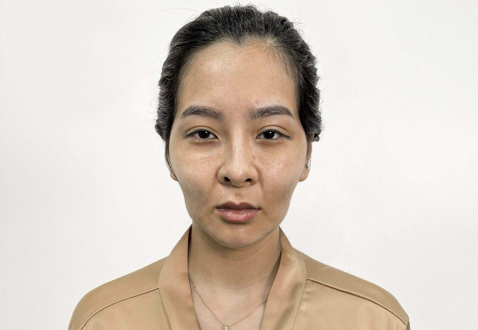 Người mặt quắt tai dơi thường có một đôi tai dài và mỏ mũi hơi nhọn