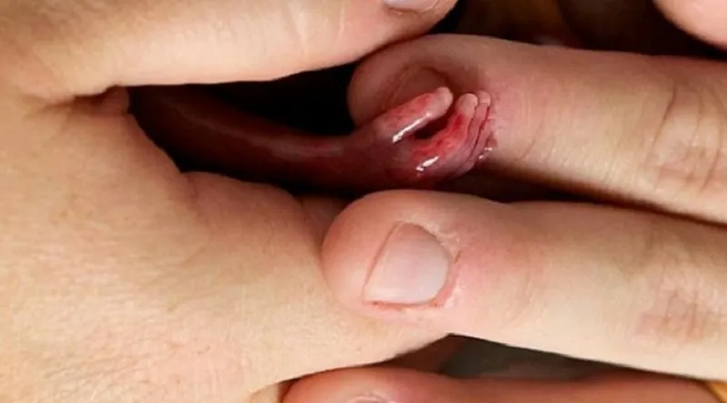 Góc nhìn khoa học: Sảy thai không phải điềm xui rủi mà do các vấn đề sức khỏe hoặc yếu tố môi trường