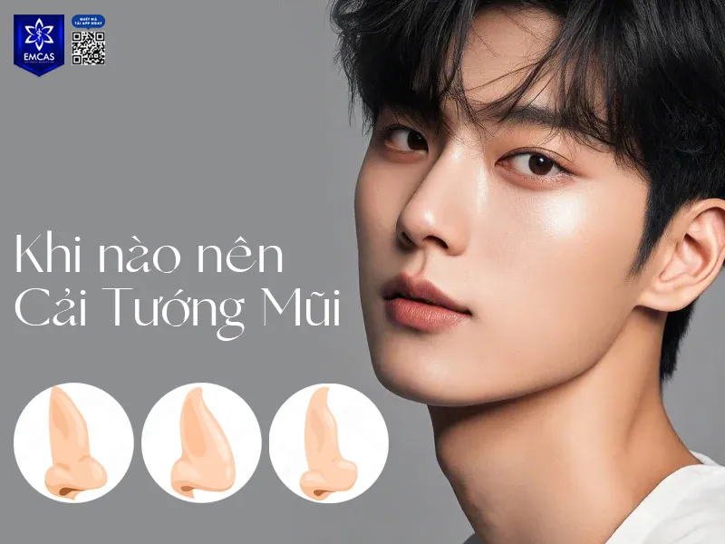 Nam giới nên tham khảo ý kiến bác sĩ chuyên khoa trước khi quyết định cải thiện dáng mũi
