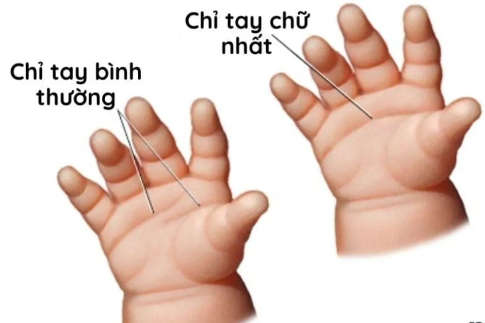 Chỉ tay chữ nhất hình thành khi đường trí đạo và tâm đạo nhập lại thành một đường duy nhất.
